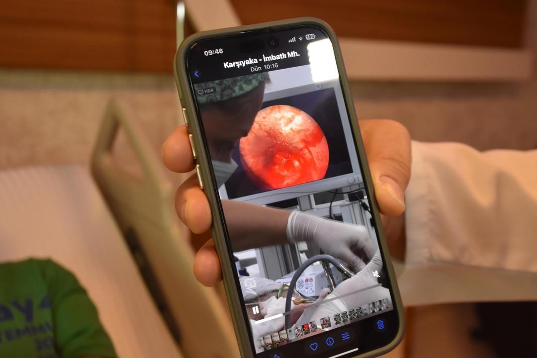 Bir öksürük raporuyla gittiği hastaneye gitti: Diş bitkisi akciğerden çıktı! 4